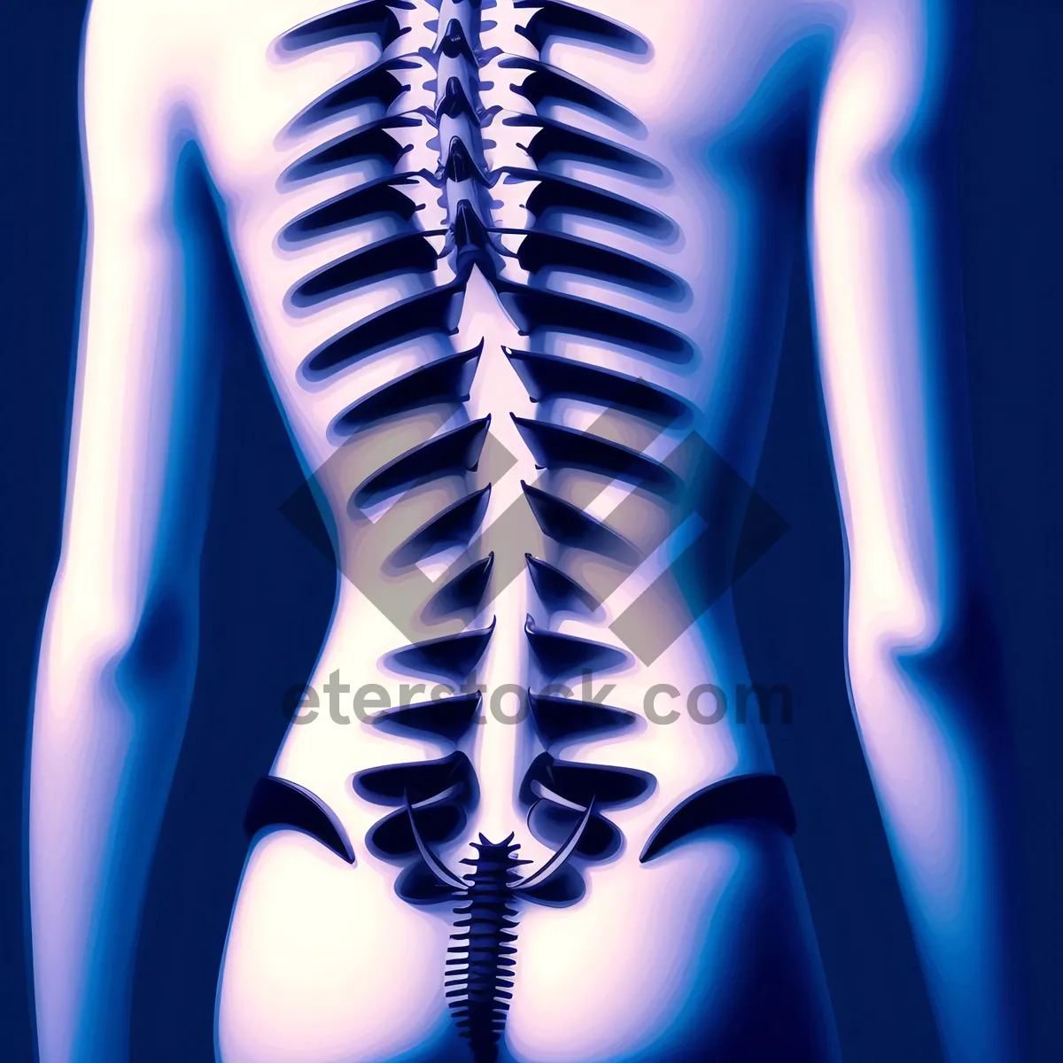 Picture of Medical Skeleton Anatomy: Inflammation in Spinal Joints