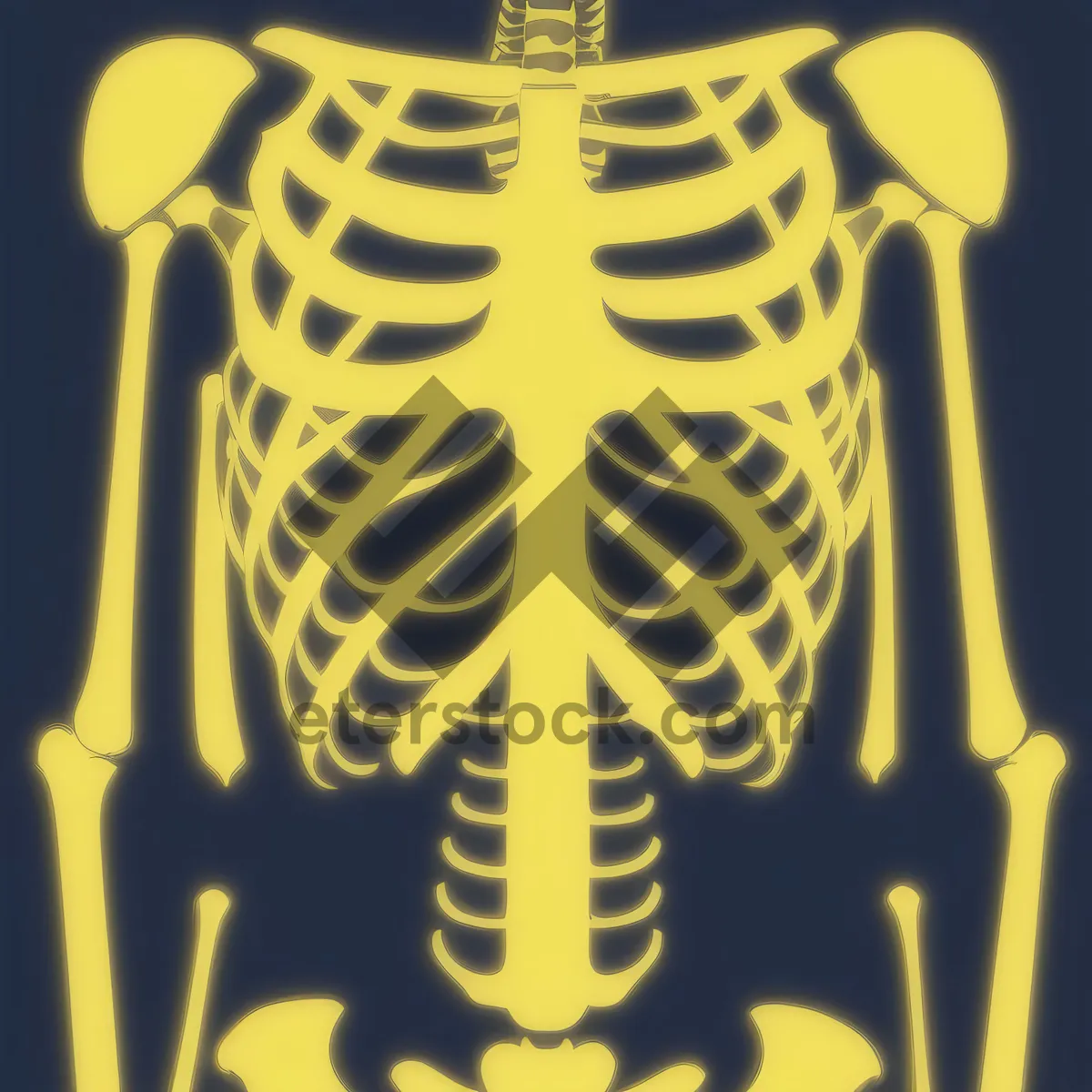 Picture of Anatomical Skeleton X-ray: Human Torso and Spine with Health Implications